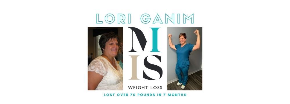 "Lori Ganim lost 70 pounds over 7 months" with a bariatric surgery before and after photo from MIIS Weight Loss Institute