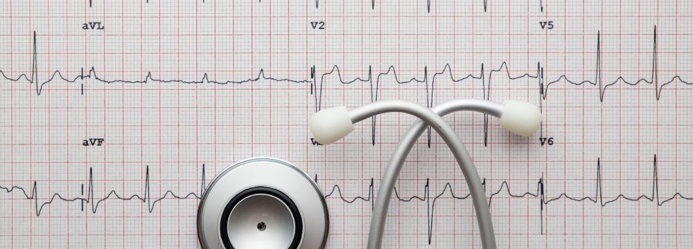 Obesity & Atrial Fibrillation (AFib)