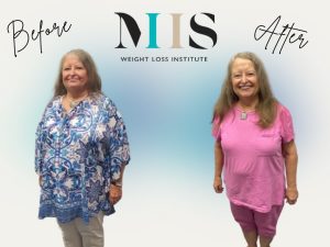 A Prima Before & After Graphic