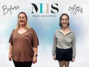 Emily A Before & After Graphic
