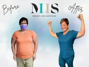 G Lori Before & After Graphic