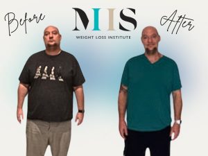 G Scott Before & After Graphic