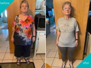 Before & After Billye Graphic