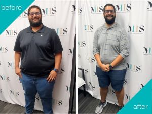 Roberto Gabino Before & After Graphic