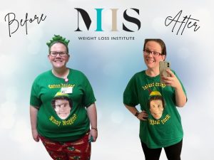 W Heather Before & After Graphic