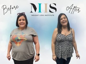 april wise before and after photo
